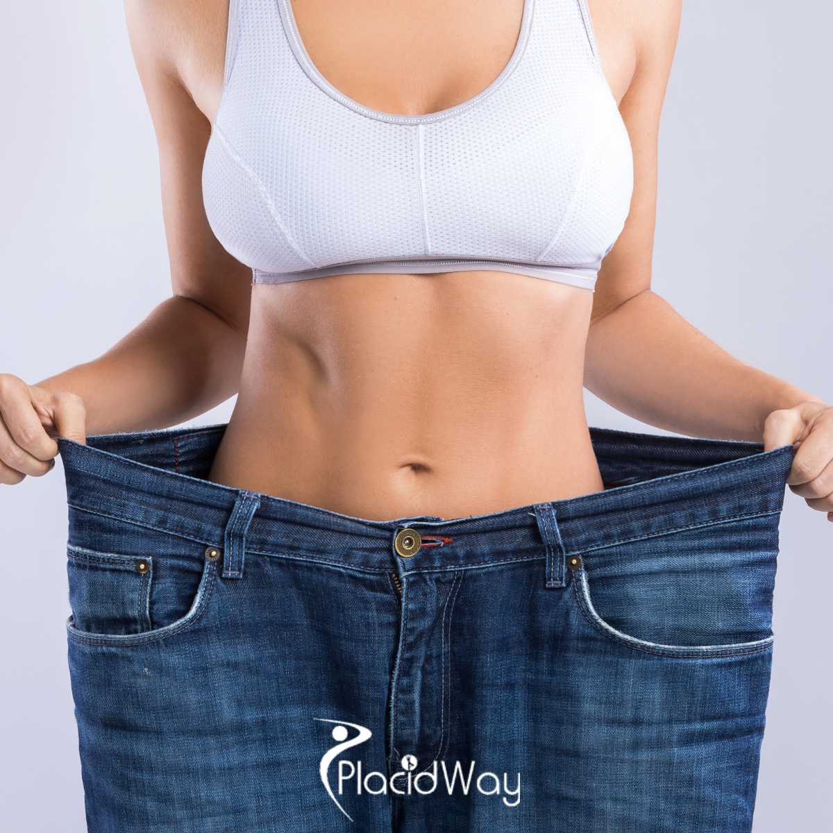 Gastric Sleeve Surgery in Turkey: A Preferred Choice for Europeans Seeking Affordable Bariatric Solutions