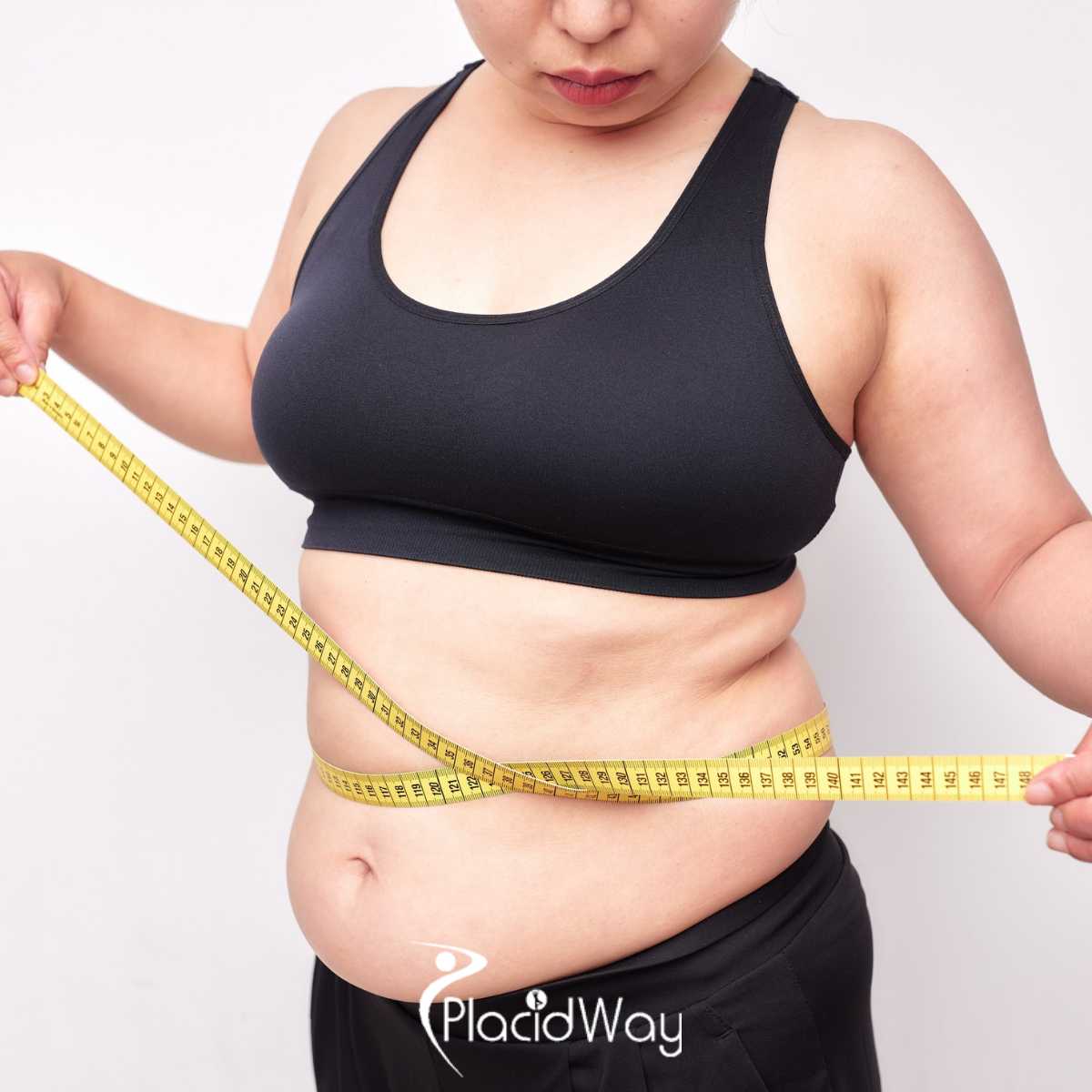 Discover Leading Bariatric Clinics in Mexico: Unlock Your Weight Loss Journey