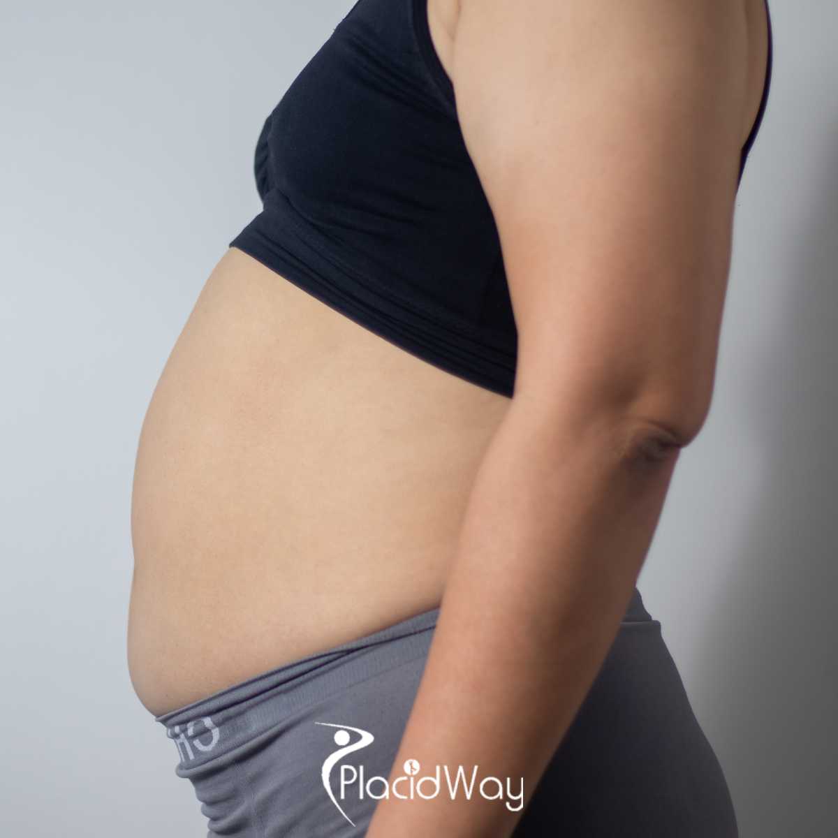 Best Gastric Sleeve Surgeons in Tijuana Mexico