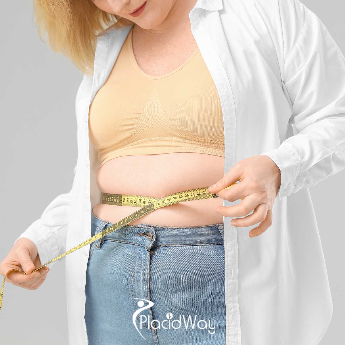 Single Incision Gastric Sleeve Surgery in Mexico - Best Clinics & Cost
