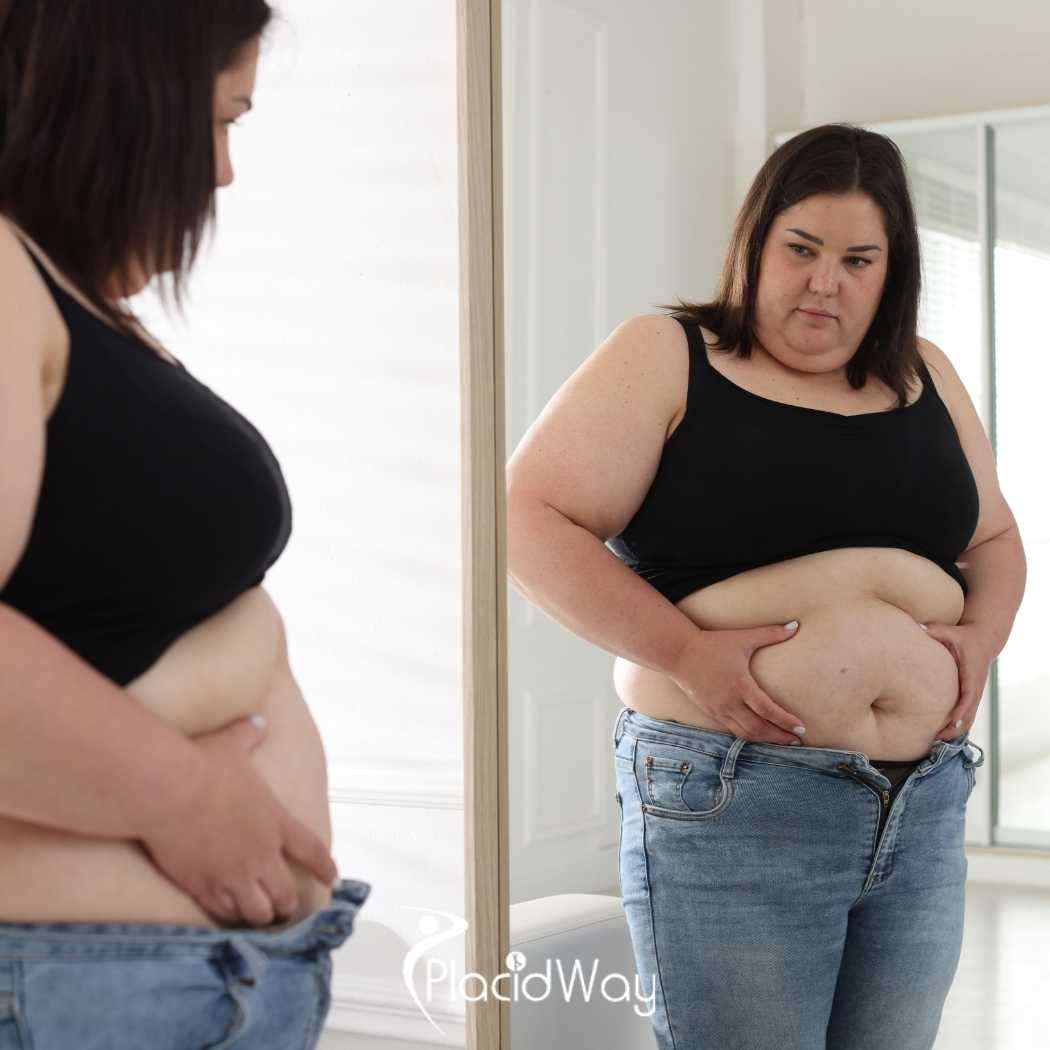 Weight Loss Surgery in Bursa: Exploring Bariatric Options in Turkey