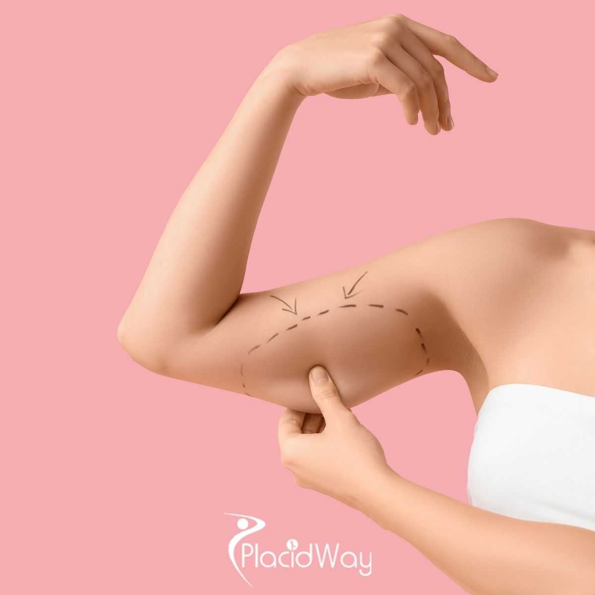 Planning Your Arm Lift in Mexico: Evaluating Safety, Surgeon Credentials, and Treatment Costs