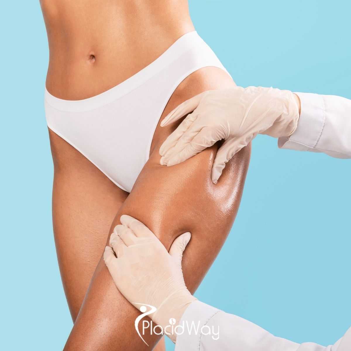 Thigh Lift in Turkey: Comprehensive Guide to Cost, Safety, and Patient Eligibility