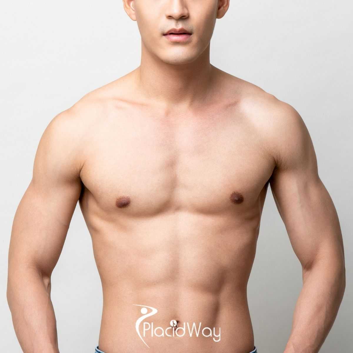 How to Safely Plan Your Gynecomastia Surgery in South Korea: Evaluating Clinics, Costs, and Care