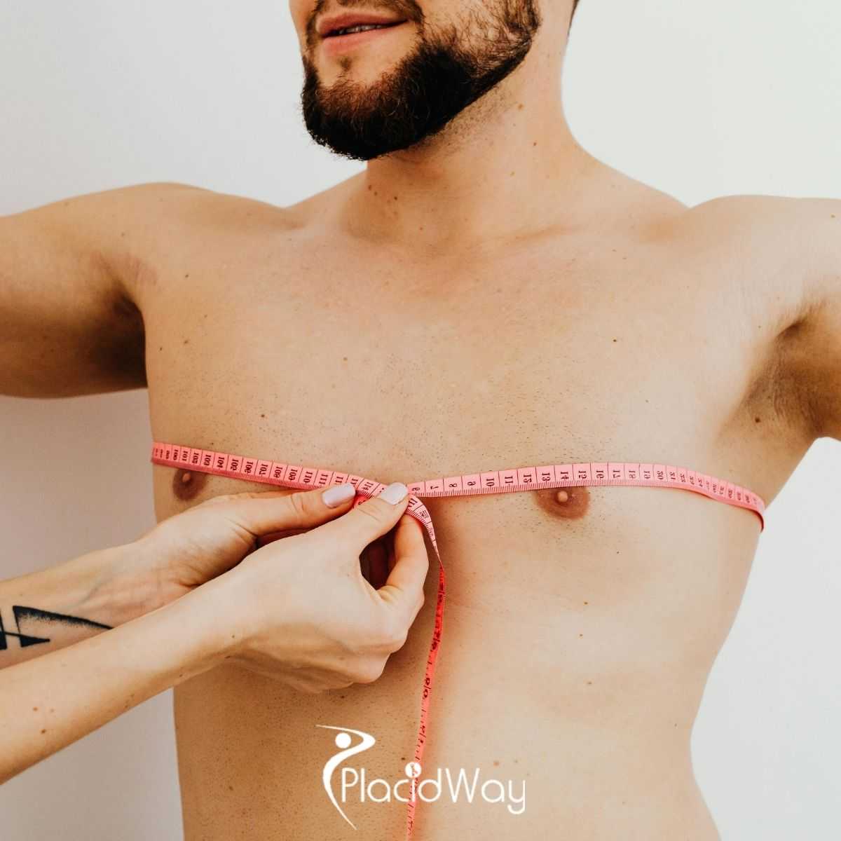 Planning Your Gynecomastia Surgery in India: Safety, Costs, and Expert Care