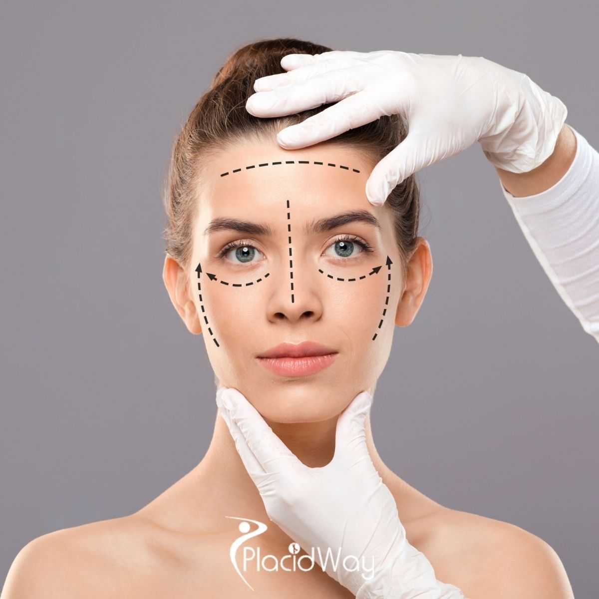 Facelift in Tijuana, Mexico: What Recovery Can Look Like for Patients