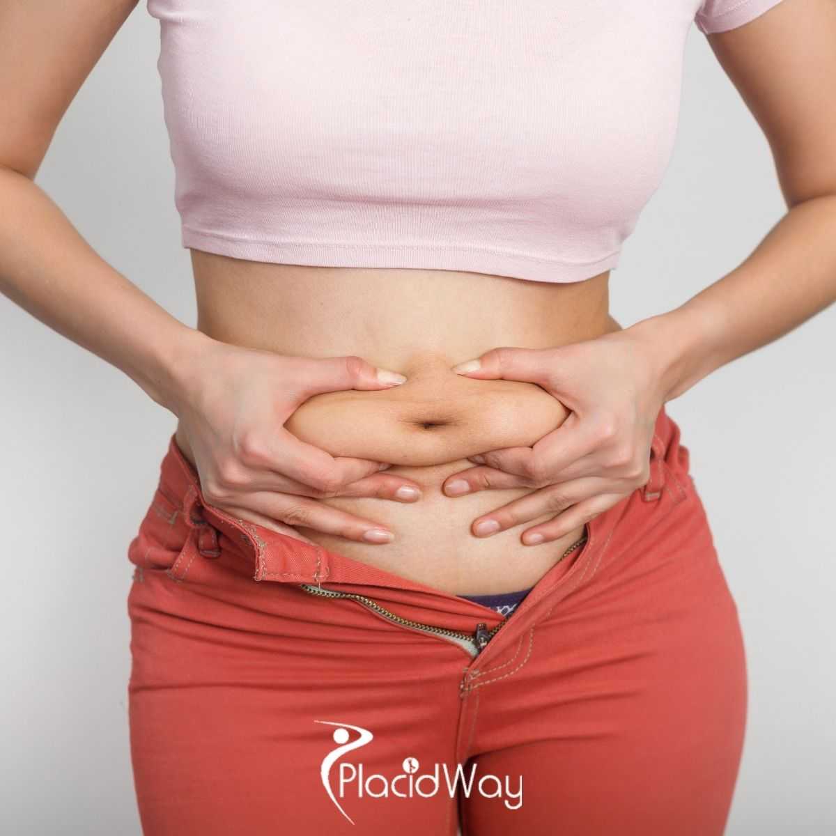 How Much Does Gastric Bypass Cost in Merida, Mexico?