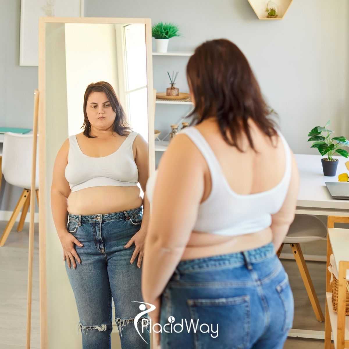 Bariatric Surgery in Mexico: Understanding Costs Before You Decide