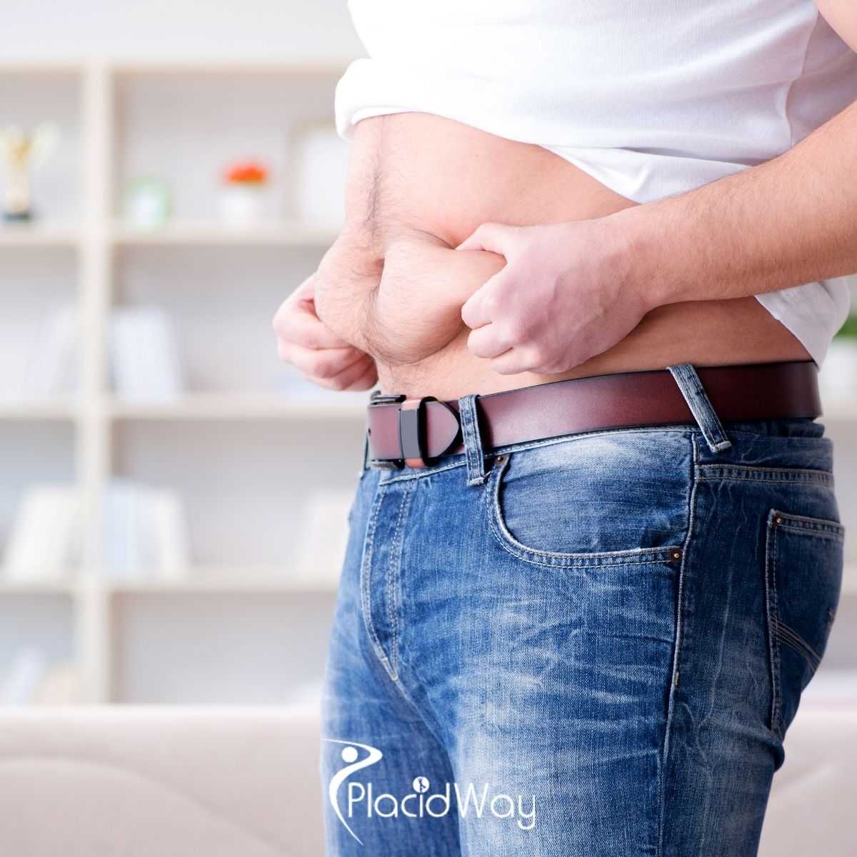 Choosing Tummy Tuck in Puerto Vallarta, Mexico: What to Evaluate Before Treatment
