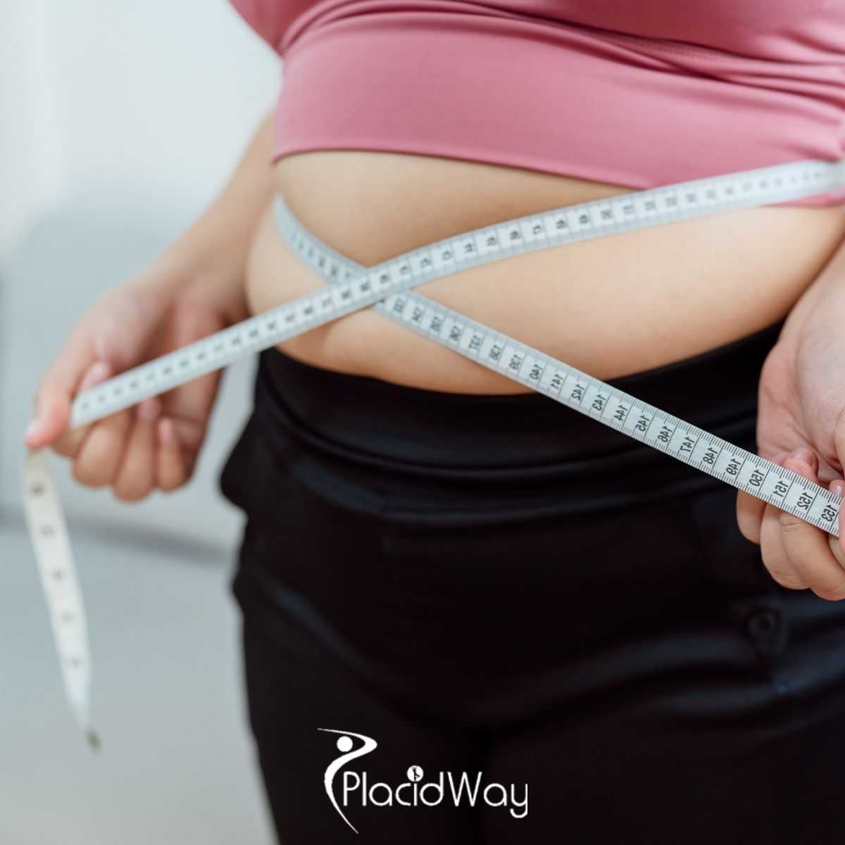 Planning Gastric Plication in New Delhi, India: What Patients Should Prepare For
