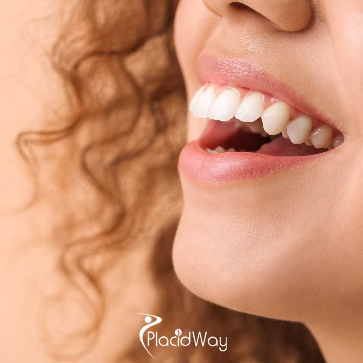 Ridge Augmentation in San Jose, Costa Rica: Understanding Costs Before You Decide
