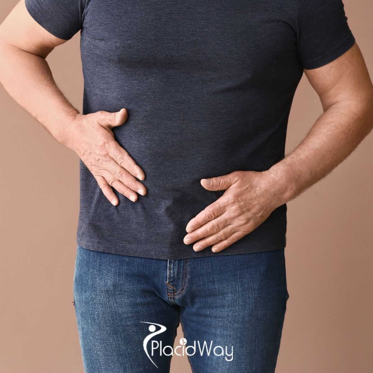 Who Is a Good Candidate for Hernia Repair in New Delhi, India?