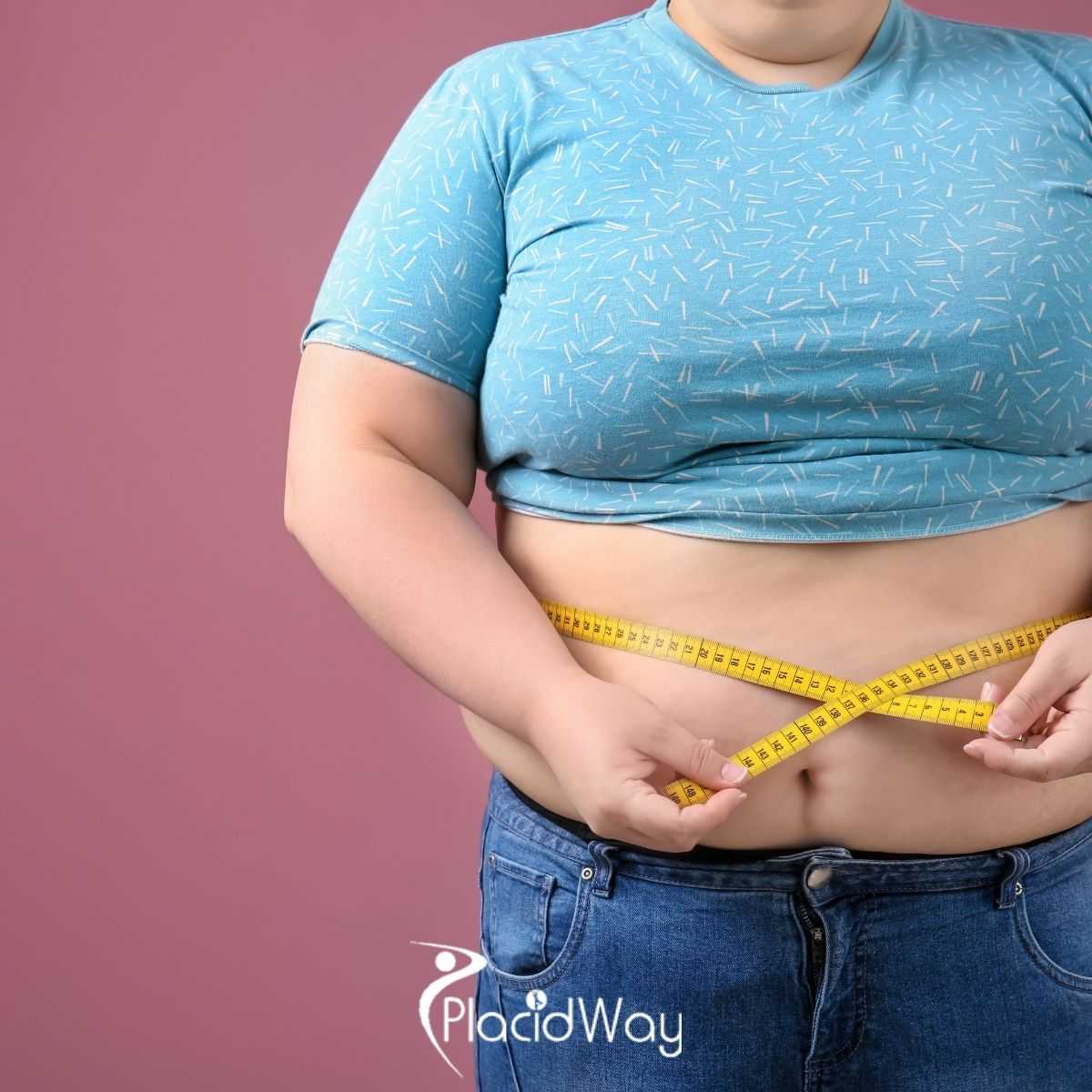 What to Expect From Bariatric Surgery in Cancun, Mexico
