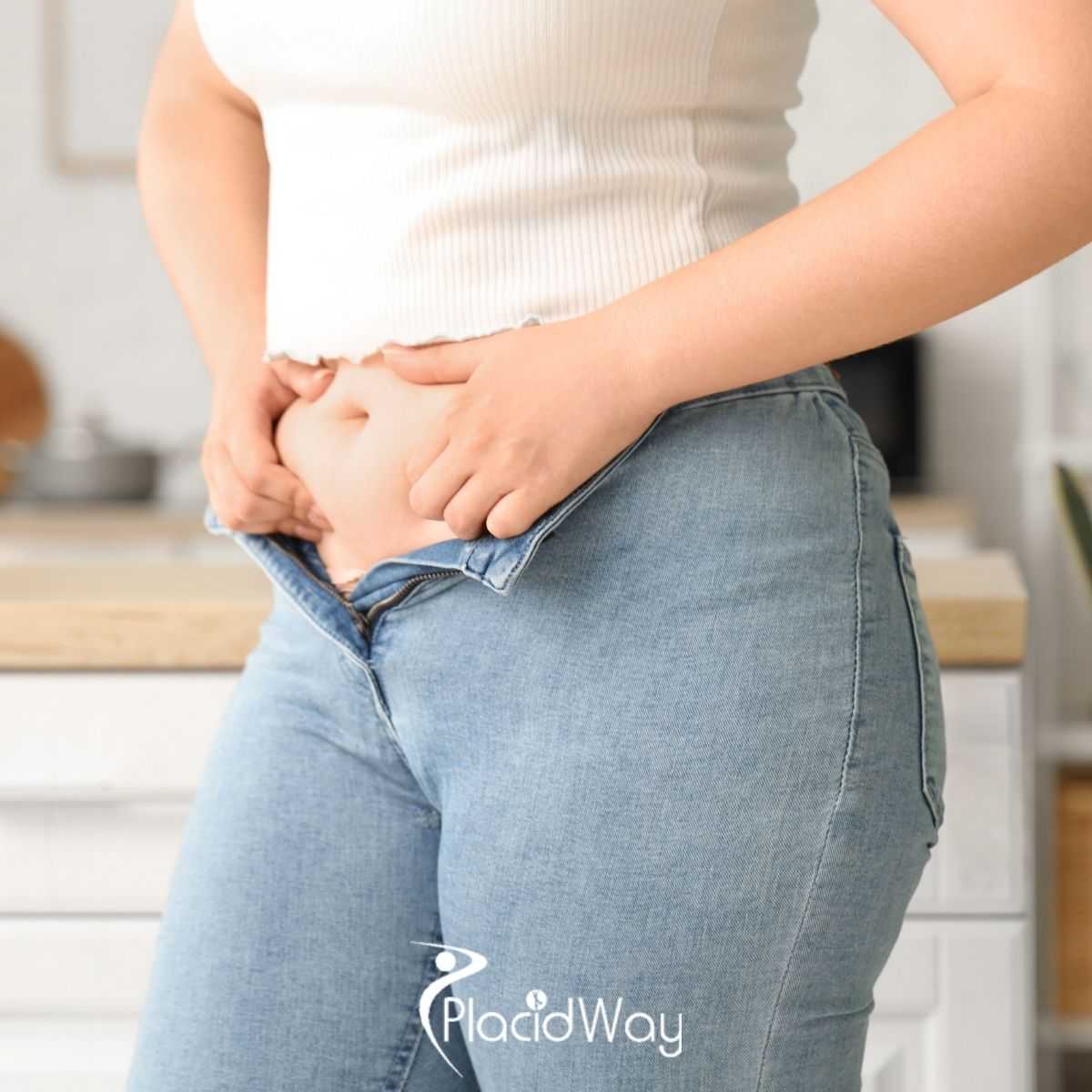 Who Is a Good Candidate for Bariatric Surgery in Cancun, Mexico?
