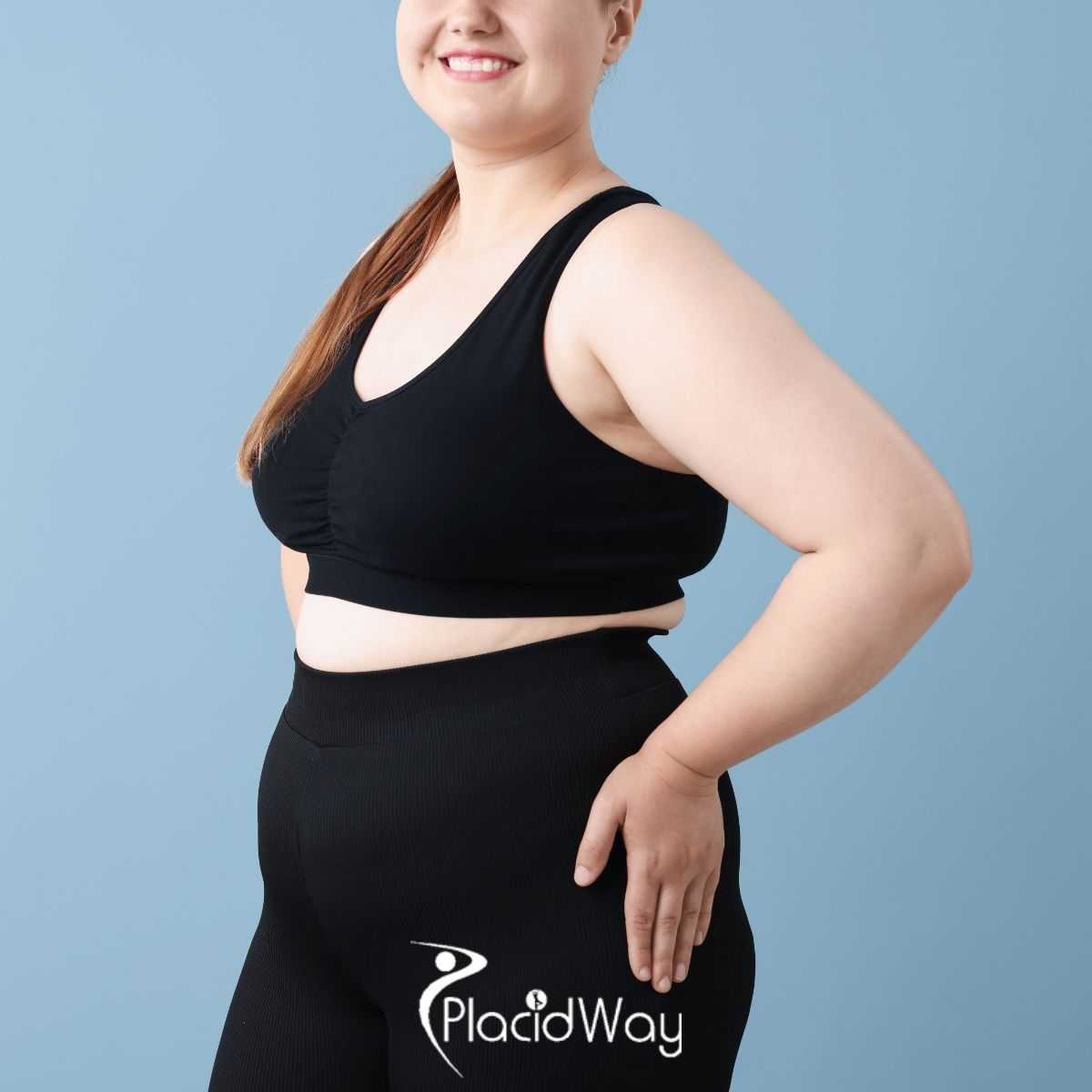 Step-by-Step: How to Get Bariatric Surgery Abroad with Confidence as a Canadian Patient