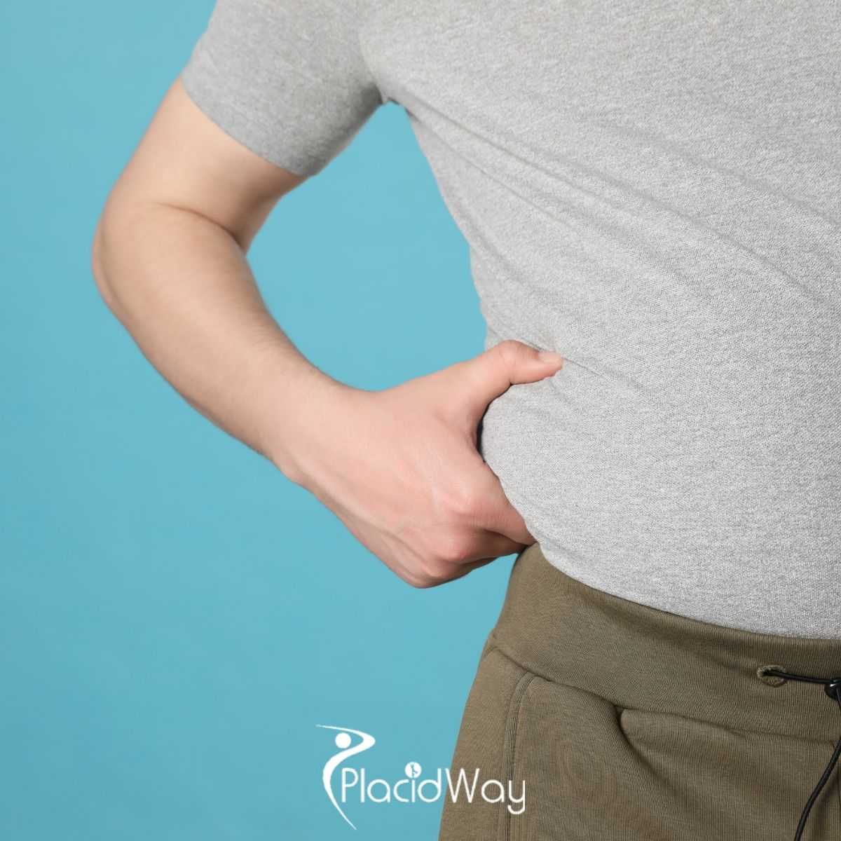 Tummy Tuck in Thailand for Australians: Nine Myths Tested