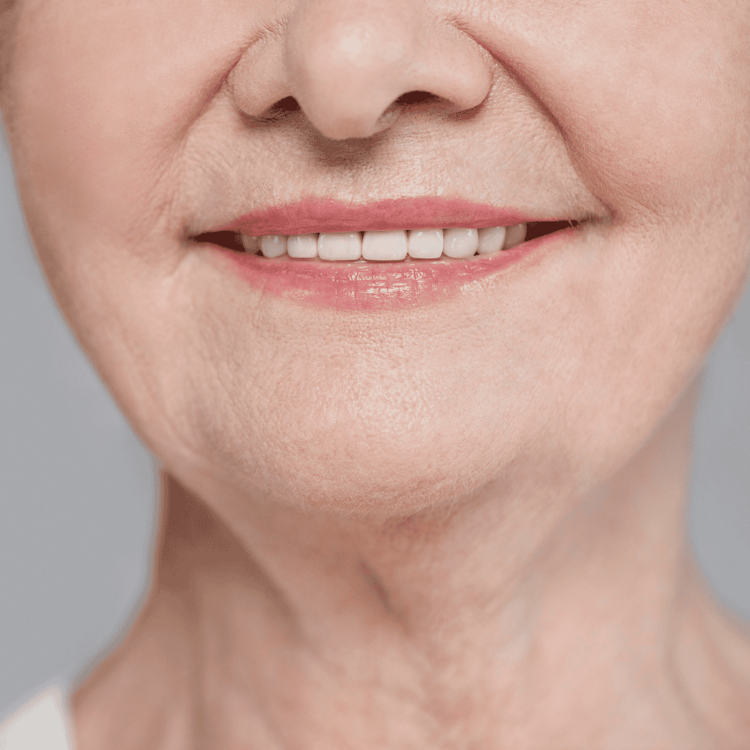 Dental Veneers in Los Algodones, Mexico