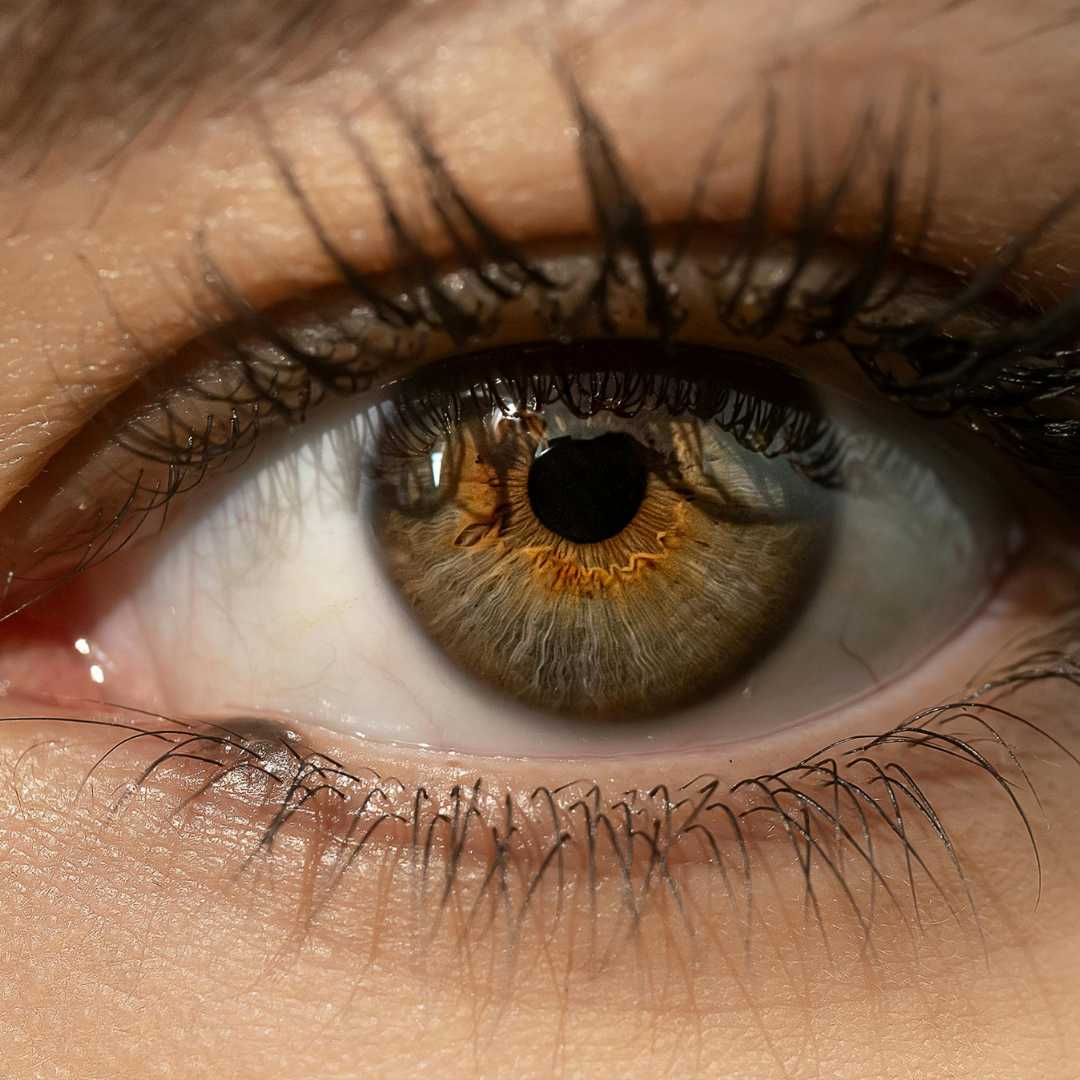 Lasik Eye Surgery in Cancun, Mexico