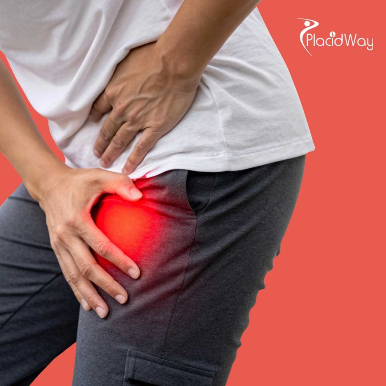 Hip Replacement in India - Find Effective Hip Surgery Package