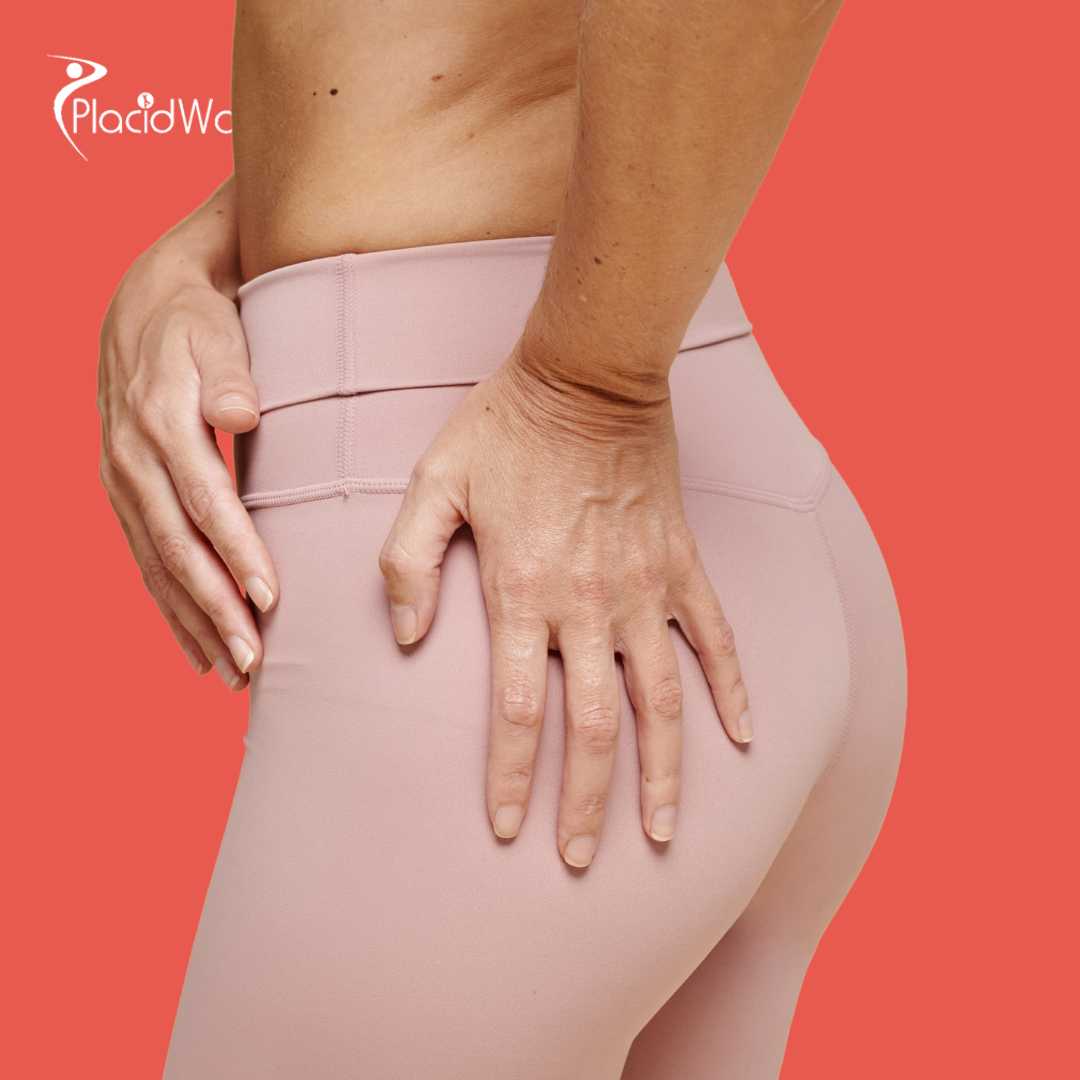 Brazilian Butt Lift in Greece