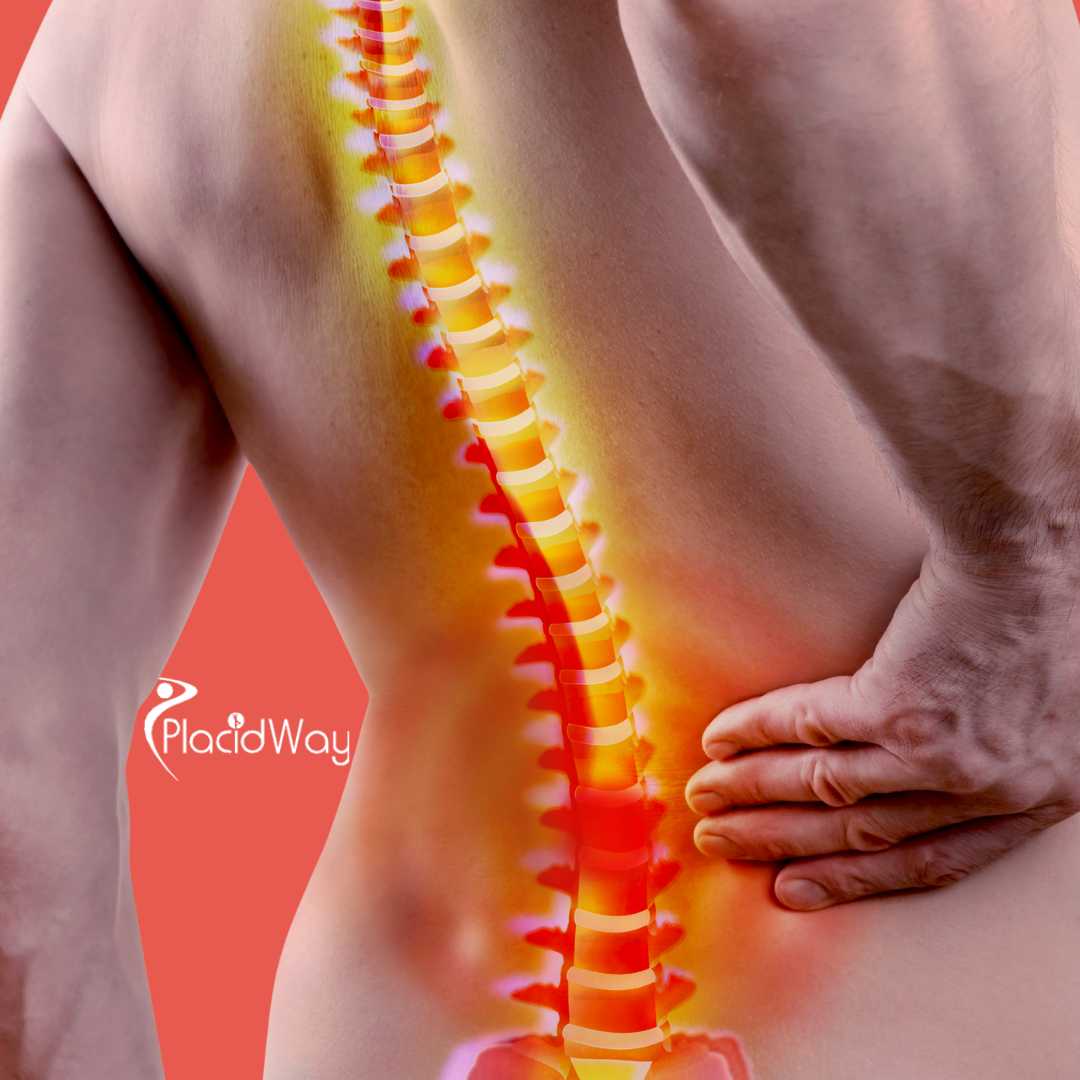 Spine Surgery in Turkey