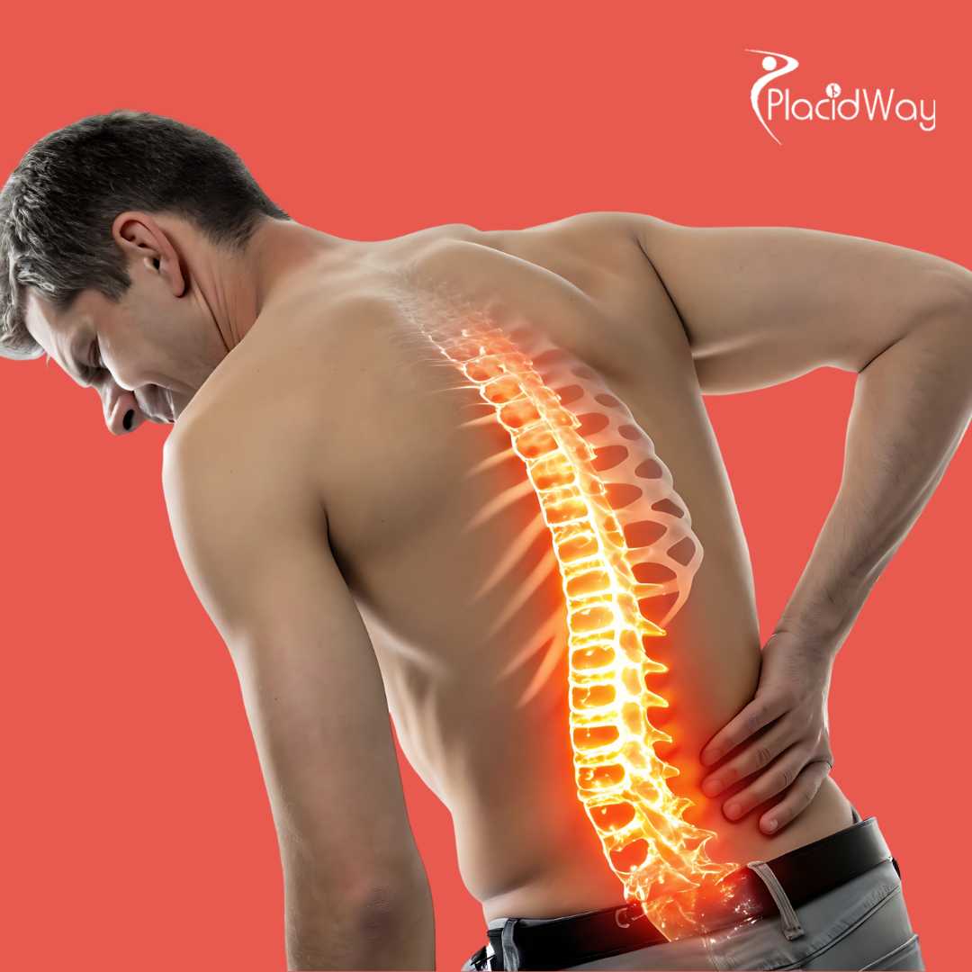 Spine Surgery in Mexico - Your Relief from Back Pain!
