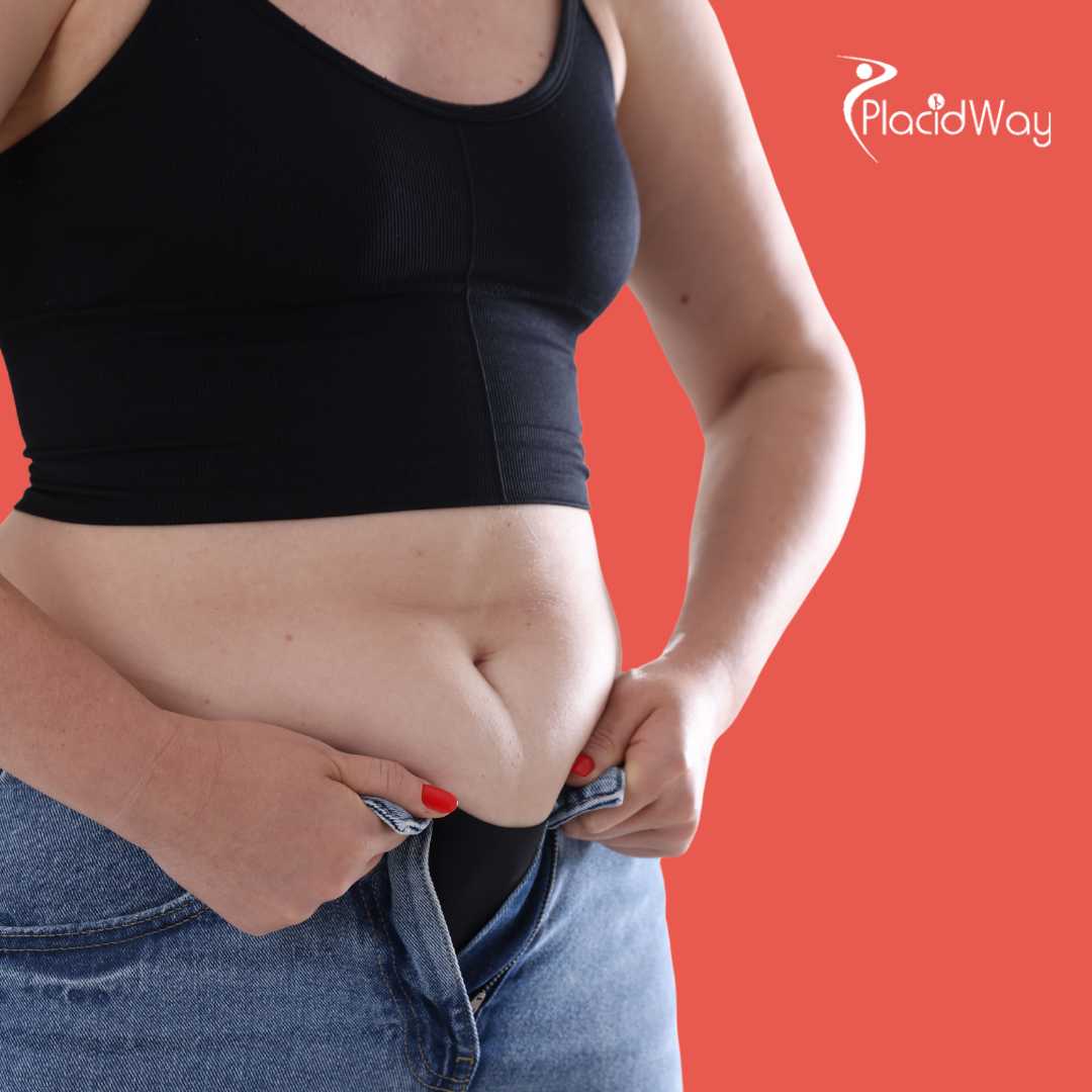 Liposuction in Istanbul Turkey