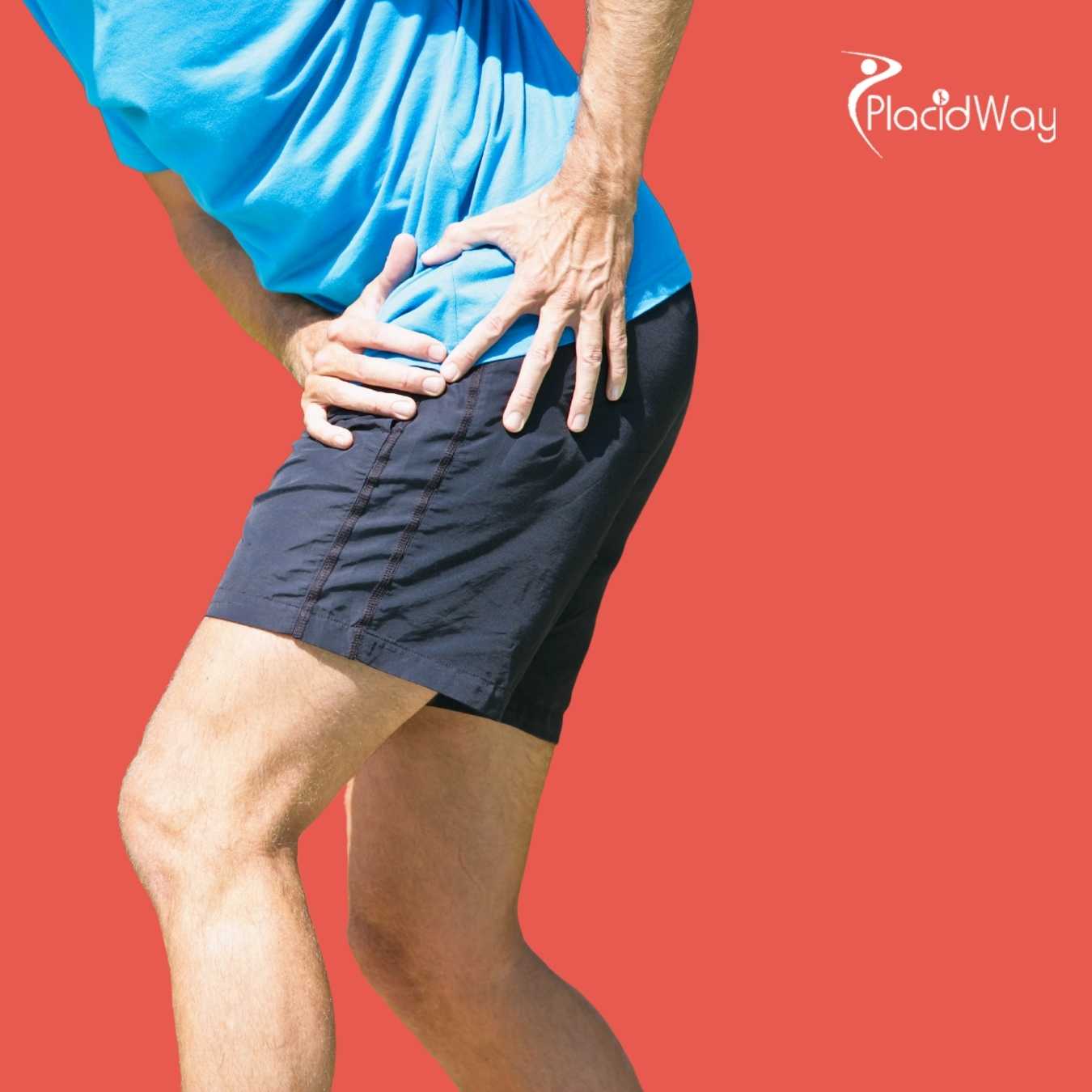 Hip Replacement Surgery in Europe