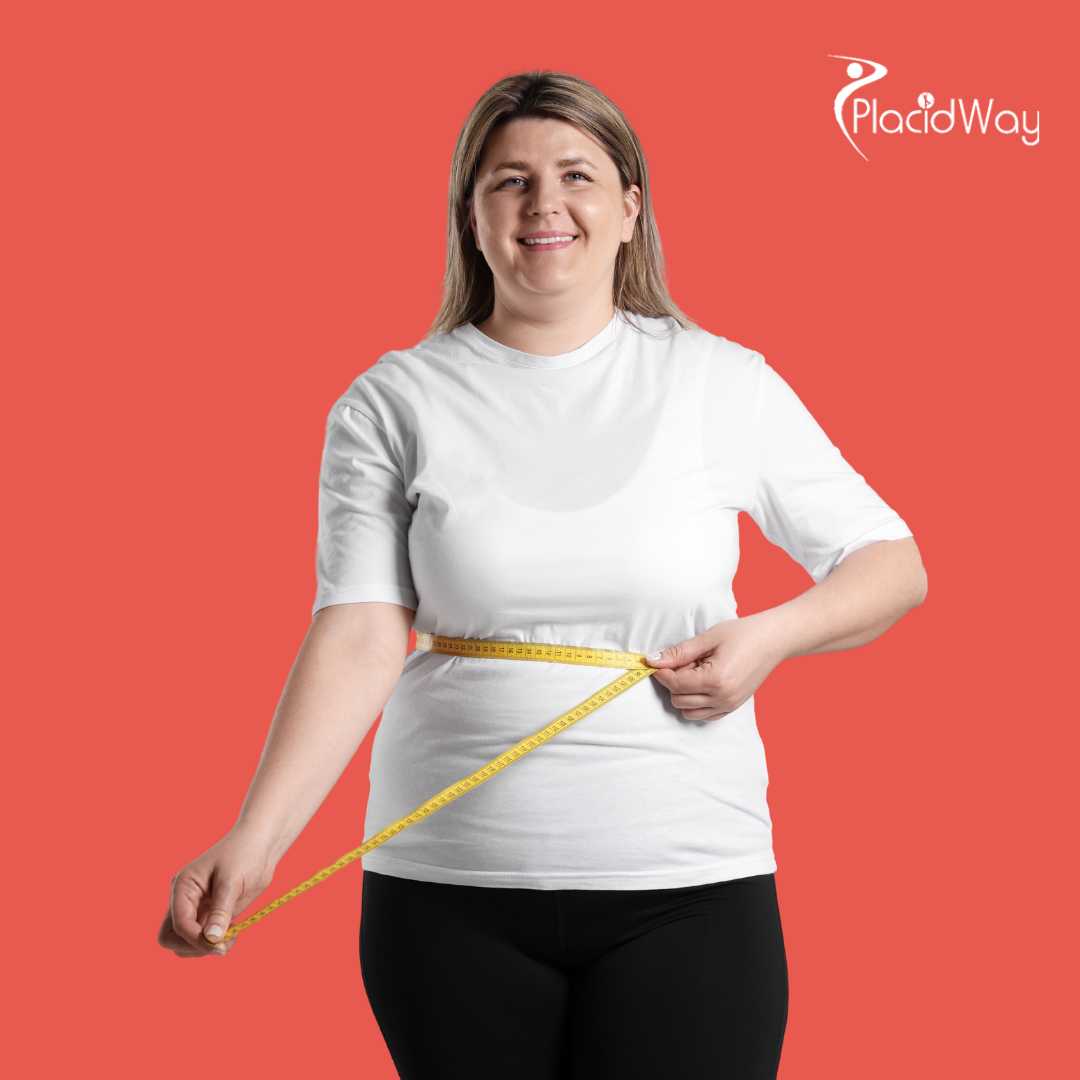 Gastric Sleeve Surgery in Tijuana, Mexico