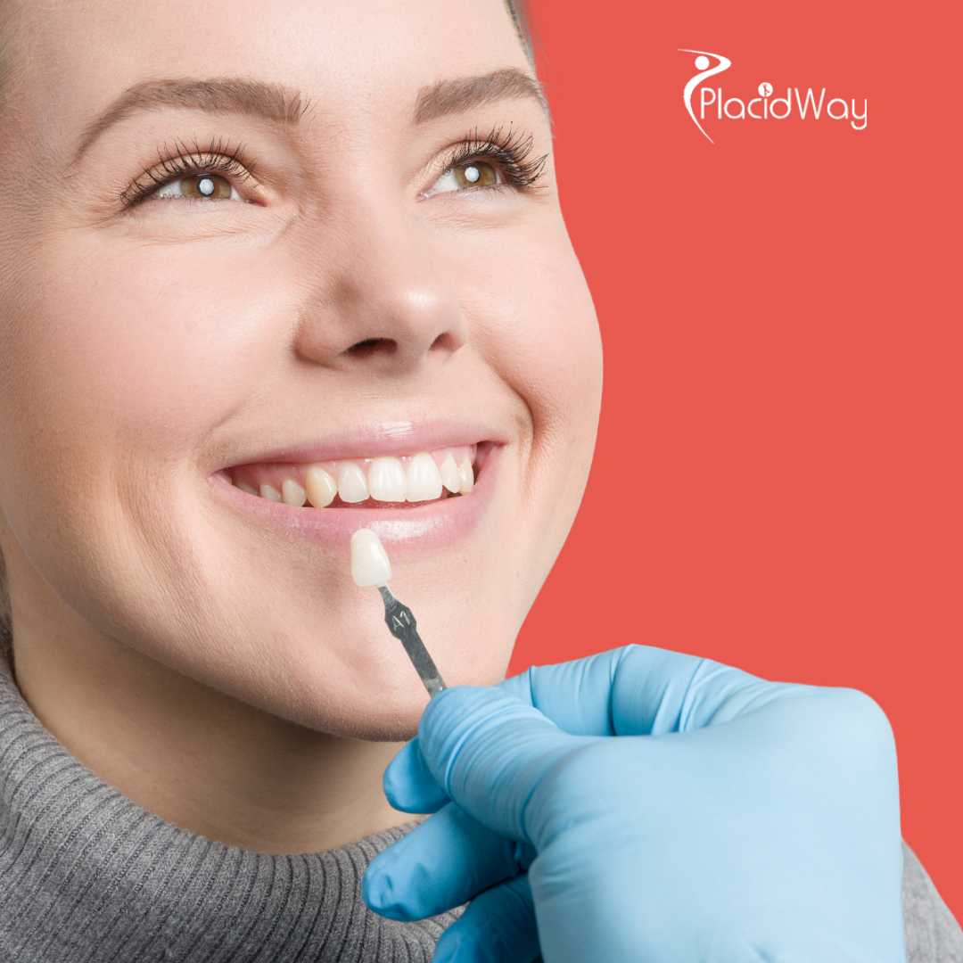 Dental Veneers in Izmir, Turkey