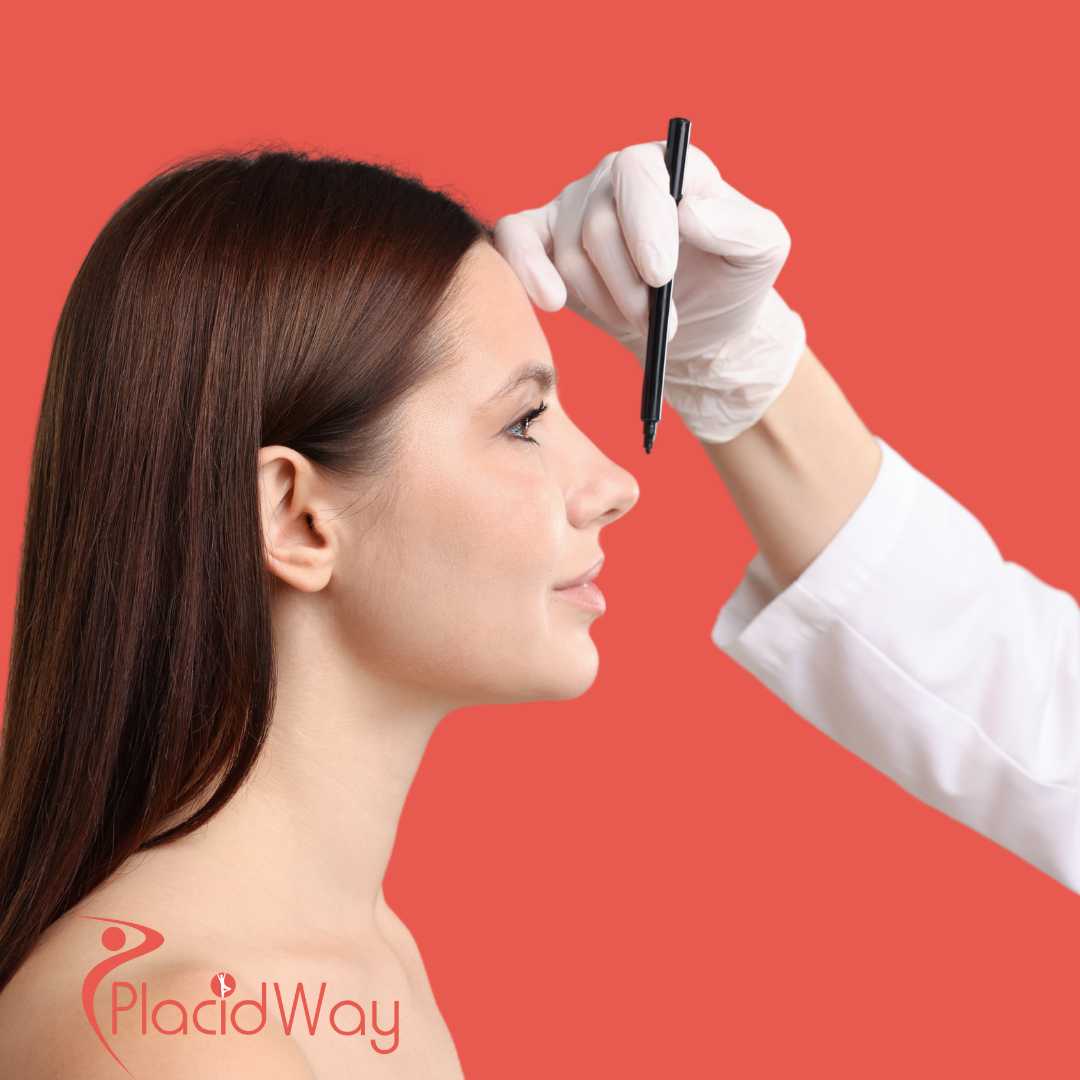 Facelift in Cancun, Mexico