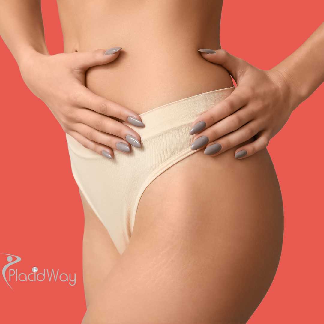 Mommy Makeover in Cancun, Mexico