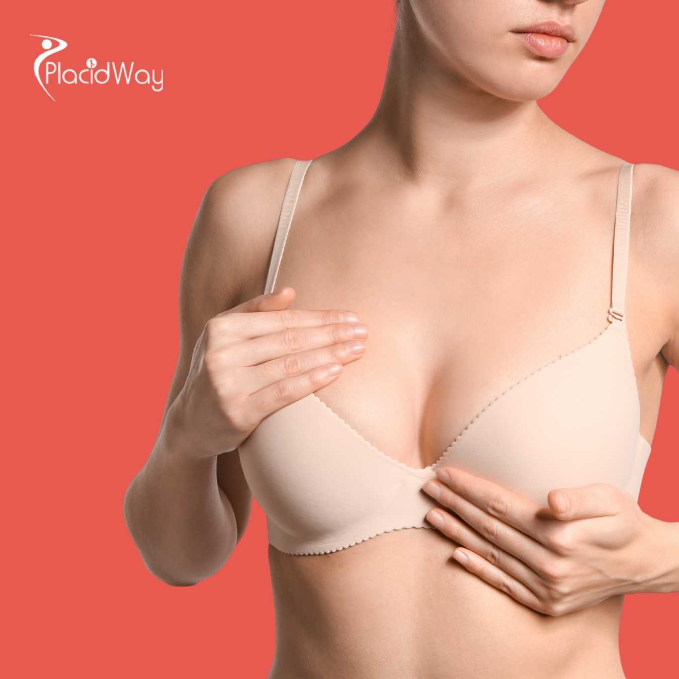 Breast Lift Surgery in Costa Rica - Improve Your Breast Aesthetics