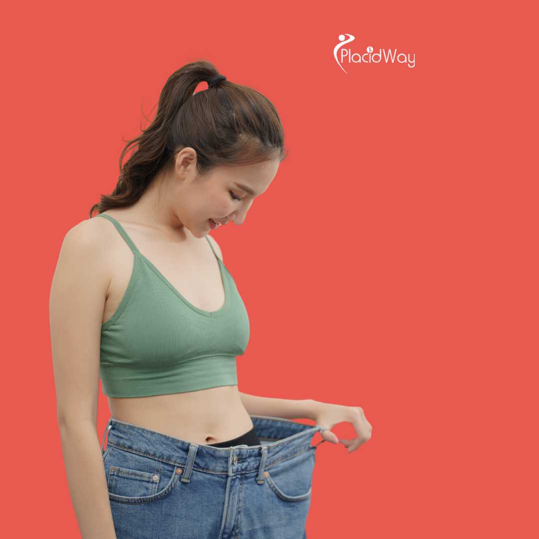 Gastric Sleeve Surgery in Merida, Mexico