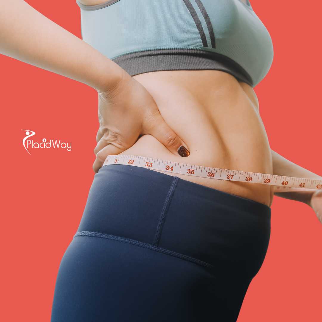 Duodenal Switch Surgery in Cancun, Mexico