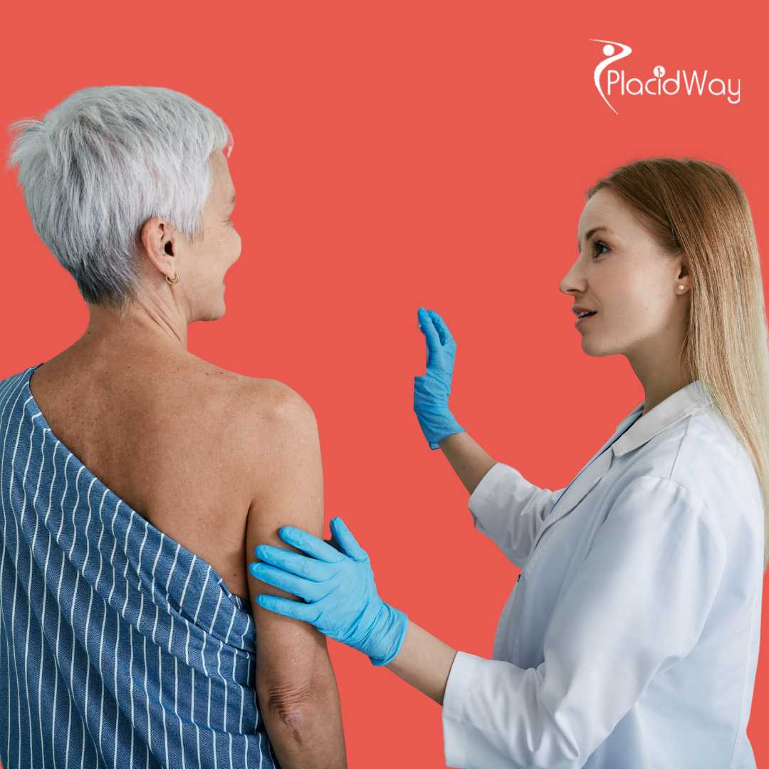 Breast Cancer Immunotherapy Tijuana, Mexico 