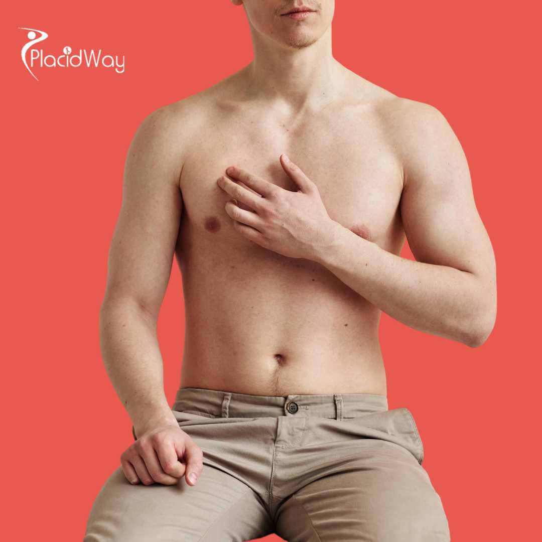 Gynecomastia Guadalajara, Mexico