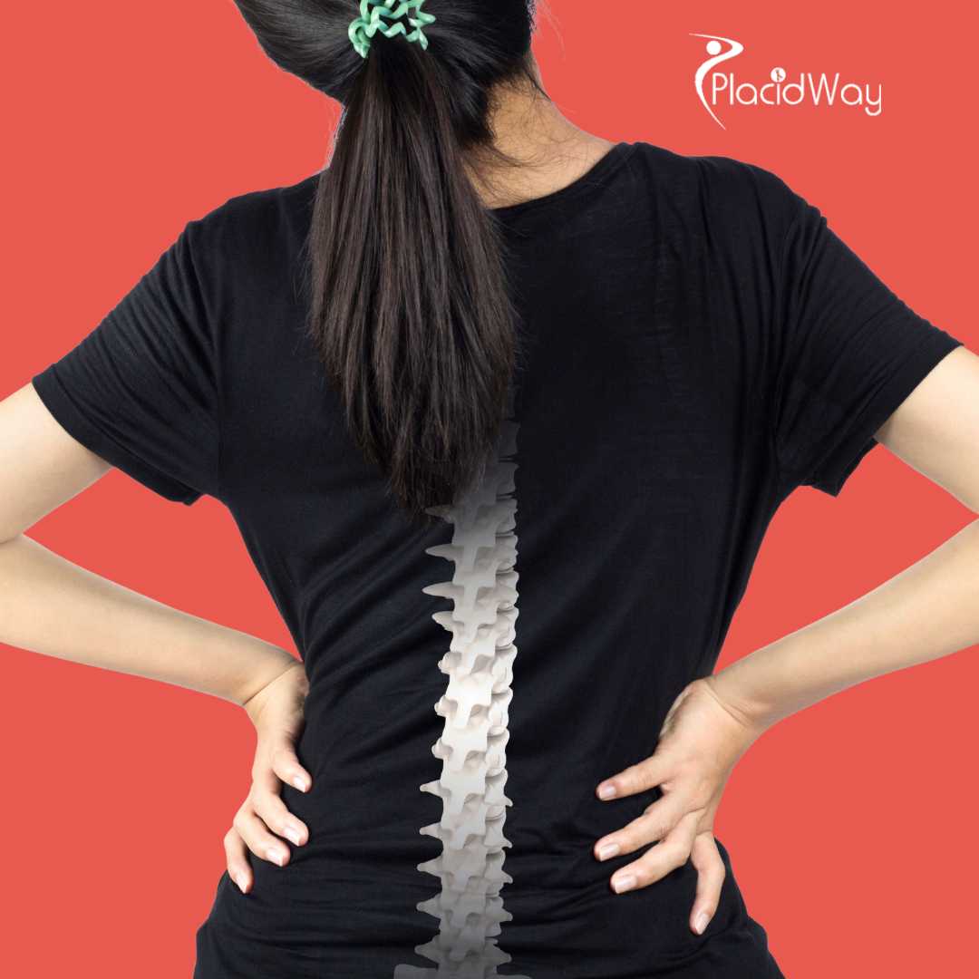 Spine Surgery in Ankara, Turkey