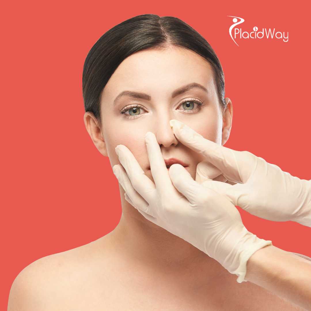 Rhinoplasty in Santo Domingo, Dominican Republic