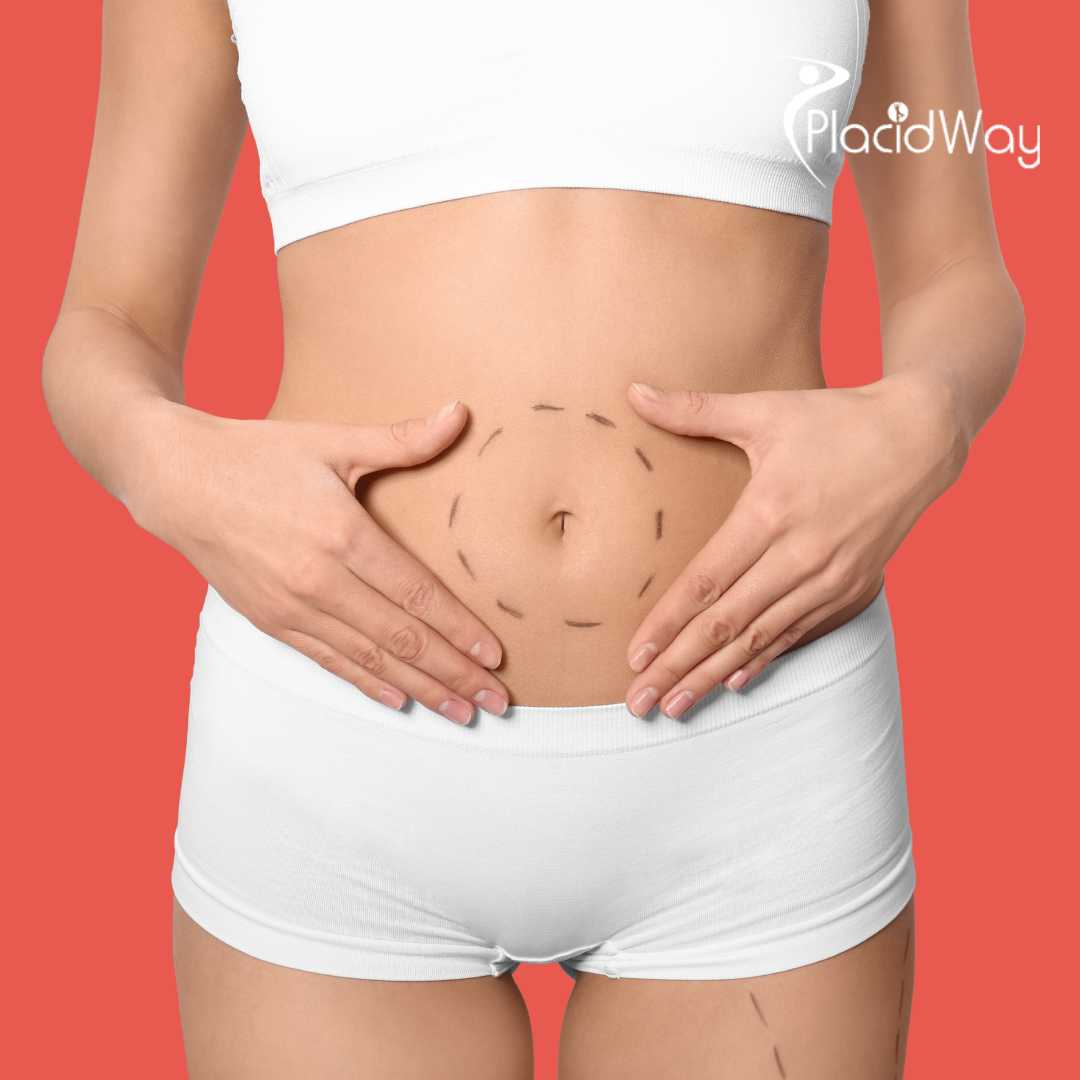 Tummy Tuck In Mumbai, India