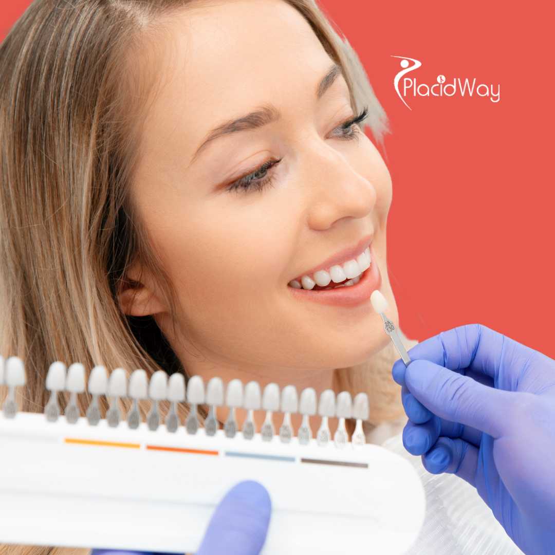 Dental Veneers in Tijuana, Mexico 