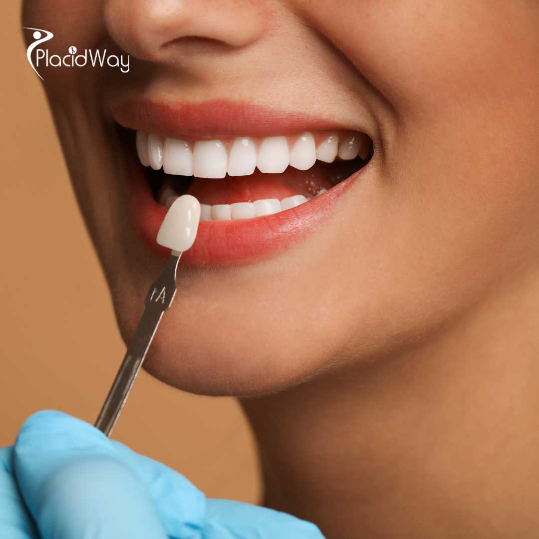 Dental Veneers in South Korea