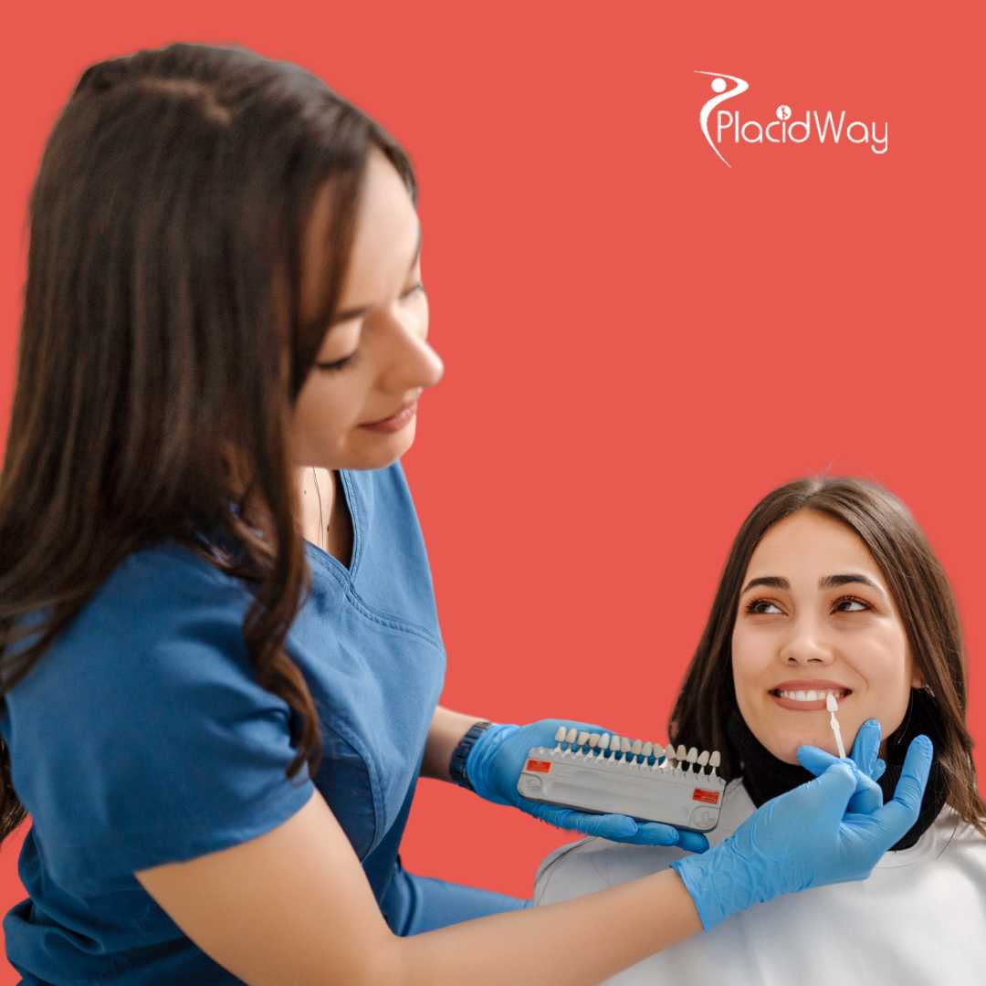 Dental Veneers in Juarez, Mexico