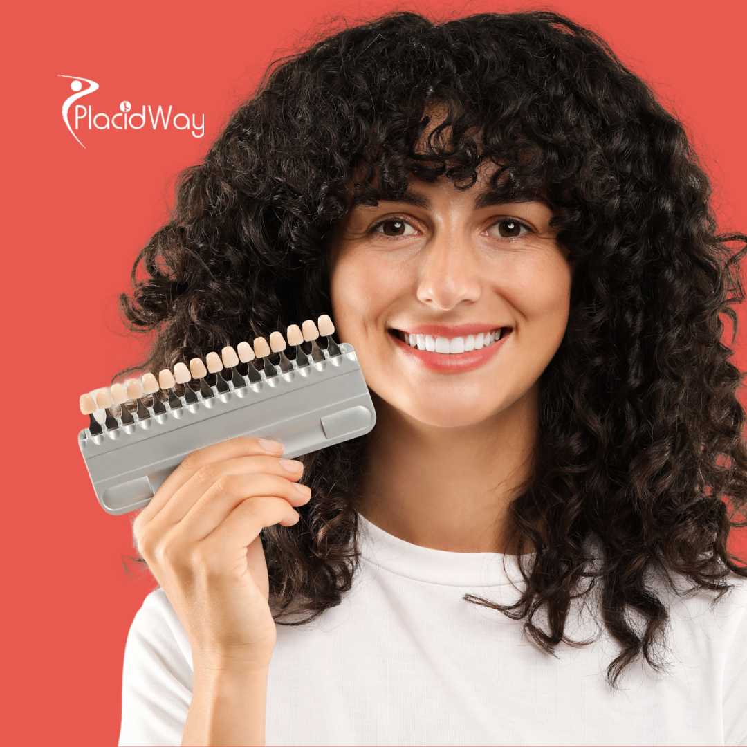 Carillas dentales en Antalya