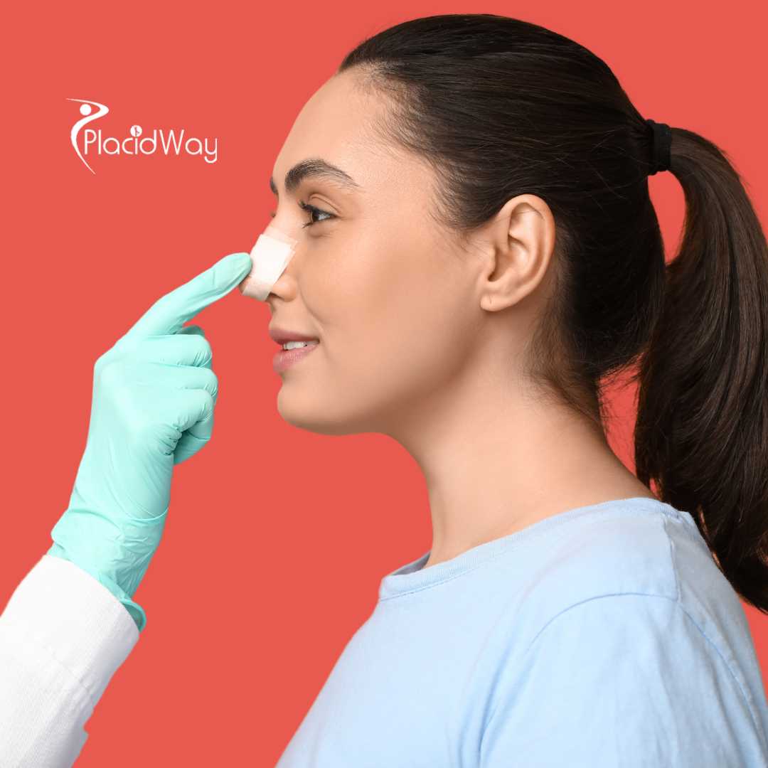 Nose Job in Colombia