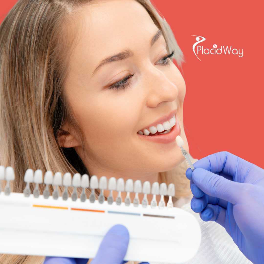 Carillas dentales en Mexicali