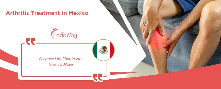 Arthritis Treatment in Mexico