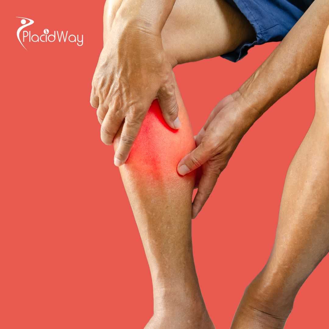 Arthritis Treatment in Mexico