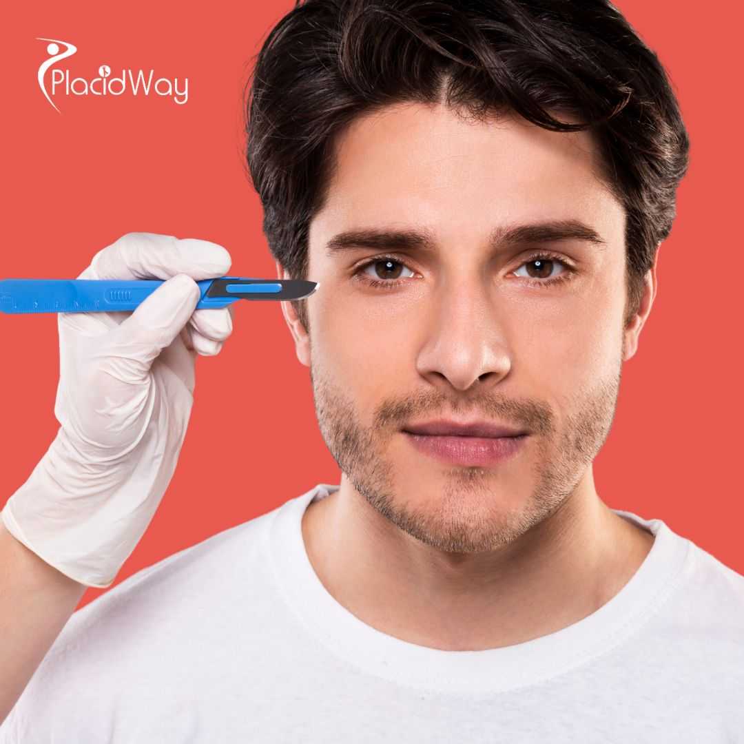 Eyelid Surgery in Istanbul, Turkey