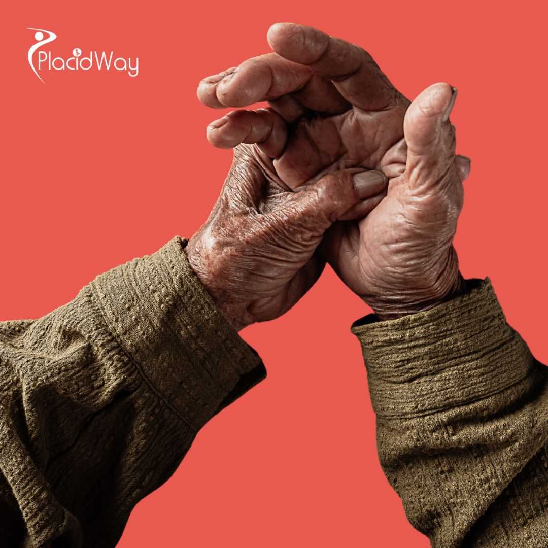 Stem Cell Therapy for Rheumatoid Arthritis in Colombia